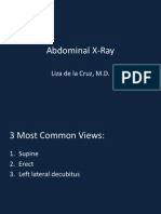 Abdominal X Ray