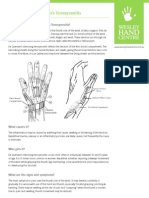 De Quervains Tenosynovitis