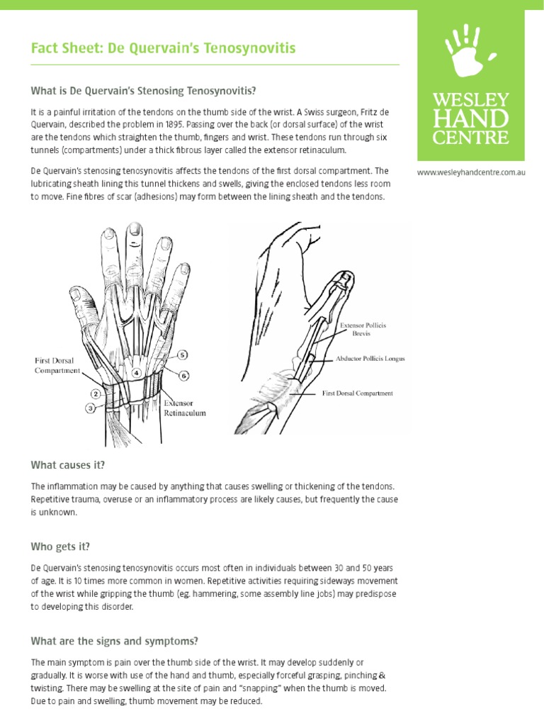 De Quervains Tenosynovitis | Musculoskeletal Disorders ...