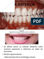 Diapositivas de Oclusion