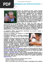 A criança com Síndrome de Down