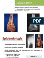 Osteosarcoma