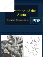 Coarctation+of+the+Aorta+ +Managements+and+Sequelae+ +Dr.+Gord+Mack+ +June+13.2006