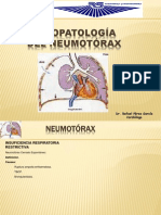 Fispa Sind Restr Neumotorax