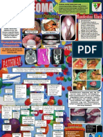 Poster Osteoma