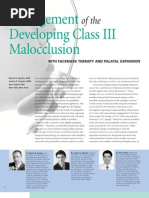 Download Management of the Developing Class III Malocclusion with Face Mask Therapy and Palatal Expansion by Garri Tsibel DDS SN13496463 doc pdf