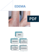 Edema