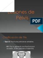 Lesiones de Pelvis