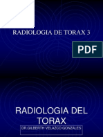 Radiologia de Torax