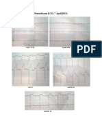 Pemeriksaan ECG