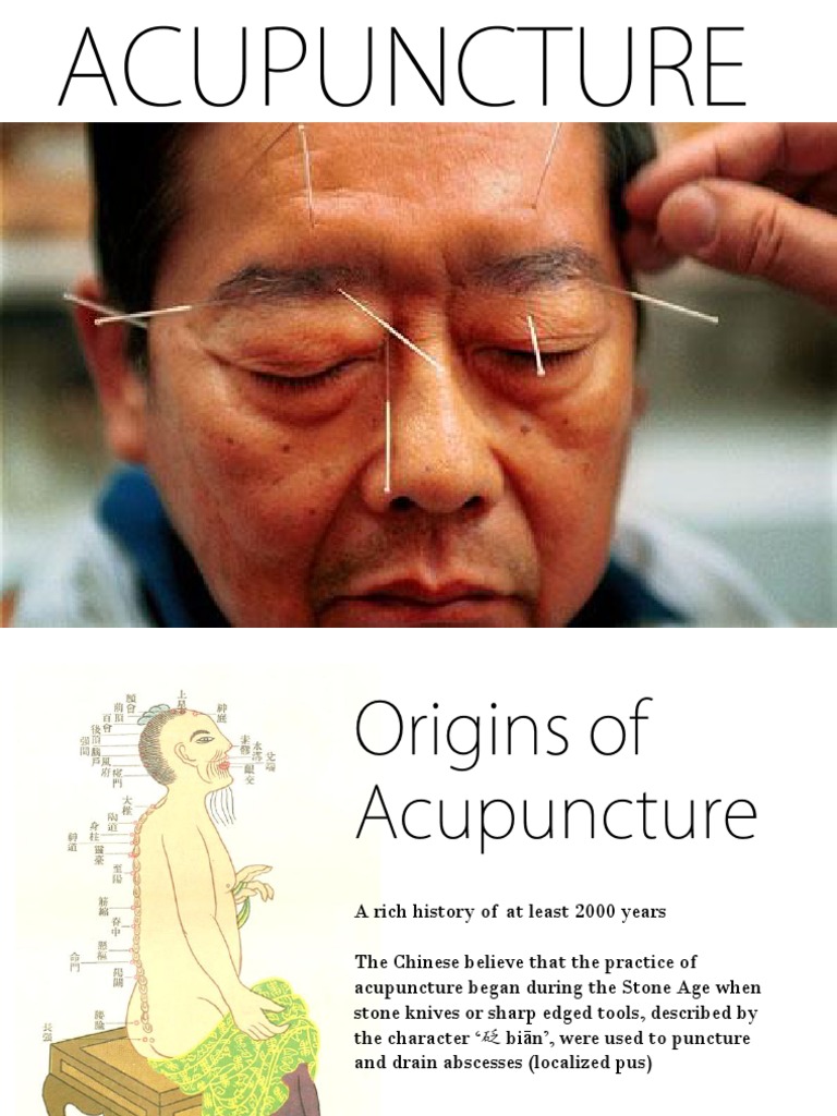 History and Efficacy of Acupuncture | PDF | Acupuncture | Traditional ...
