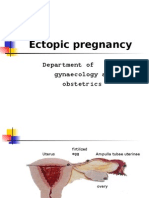 Ectopic Pregnancy: Department of Gynaecology and Obstetrics