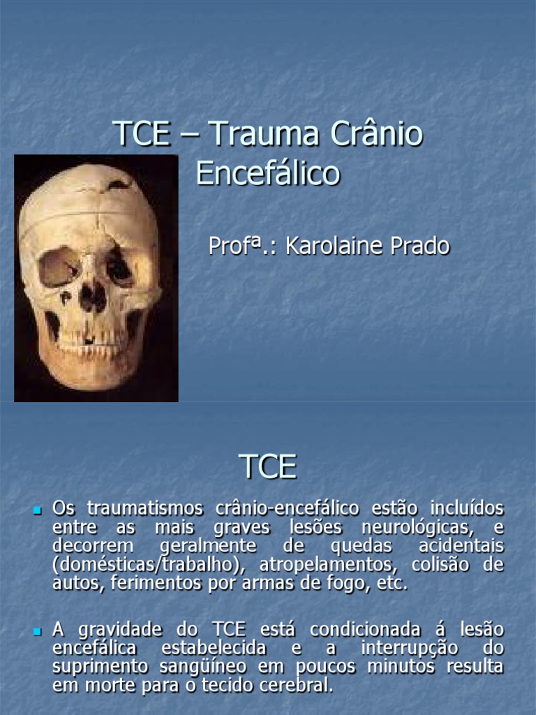 TCE - Trauma Crânio Encefálico: Prof .: Karolaine Prado | PDF ...