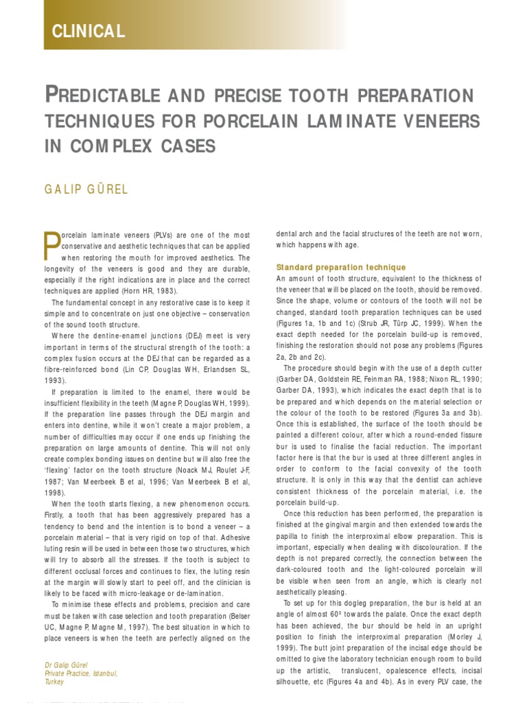 Redictable and Precise Tooth Preparation Techniques For Porcelain