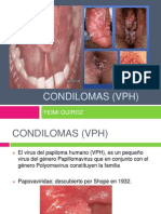 Condilomas (VPH) Expo