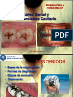 Caries Dental- Biomateriales