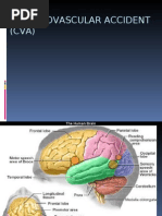 Cerebrovascular Accident