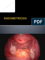Endometriosis Treatment and Management Overview