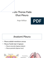 Efusi Pleura