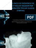 CASO CLÌNICO DE EXODONCIA DE TERCER MOLAR INFERIOR