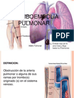 Tromboembolia Pulmonar