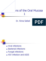5. Infections of the Oral Mucosa 1 (Slide 10 + 11)