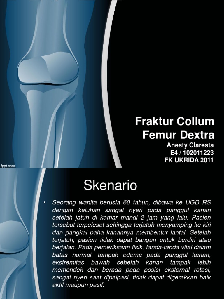 icd 10 susp fraktur collum femur