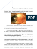 Pterygium