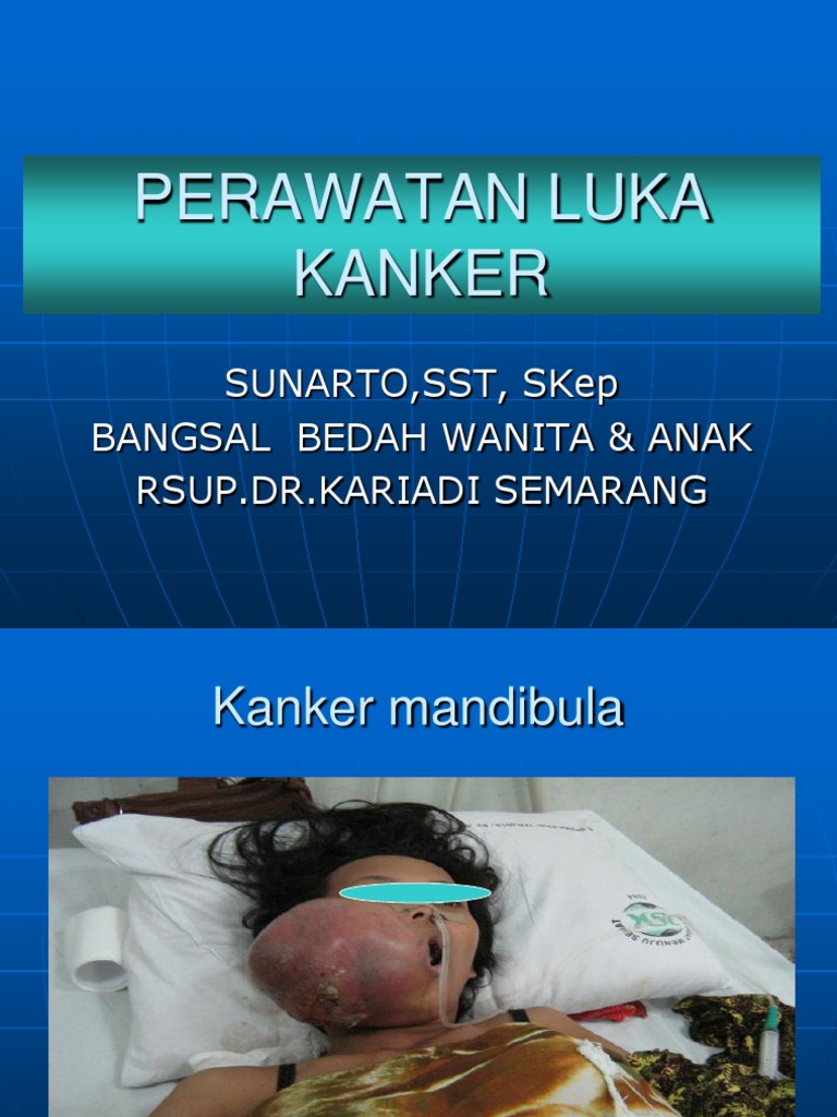 Perawatan Luka Kanker