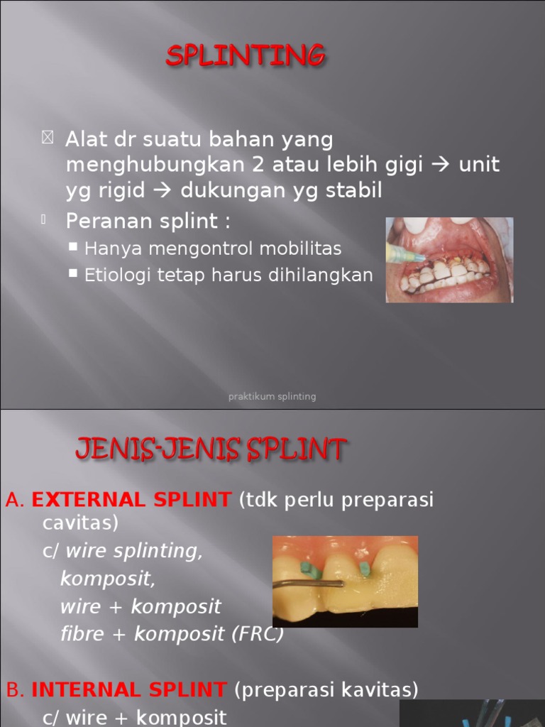 Panduan Praktikum Splinting Gigi | PDF