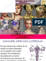 Cancer Cervico Uterino