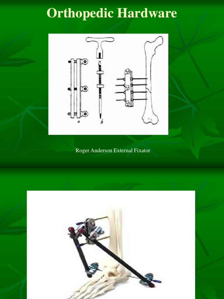 Orthopedic Hardware