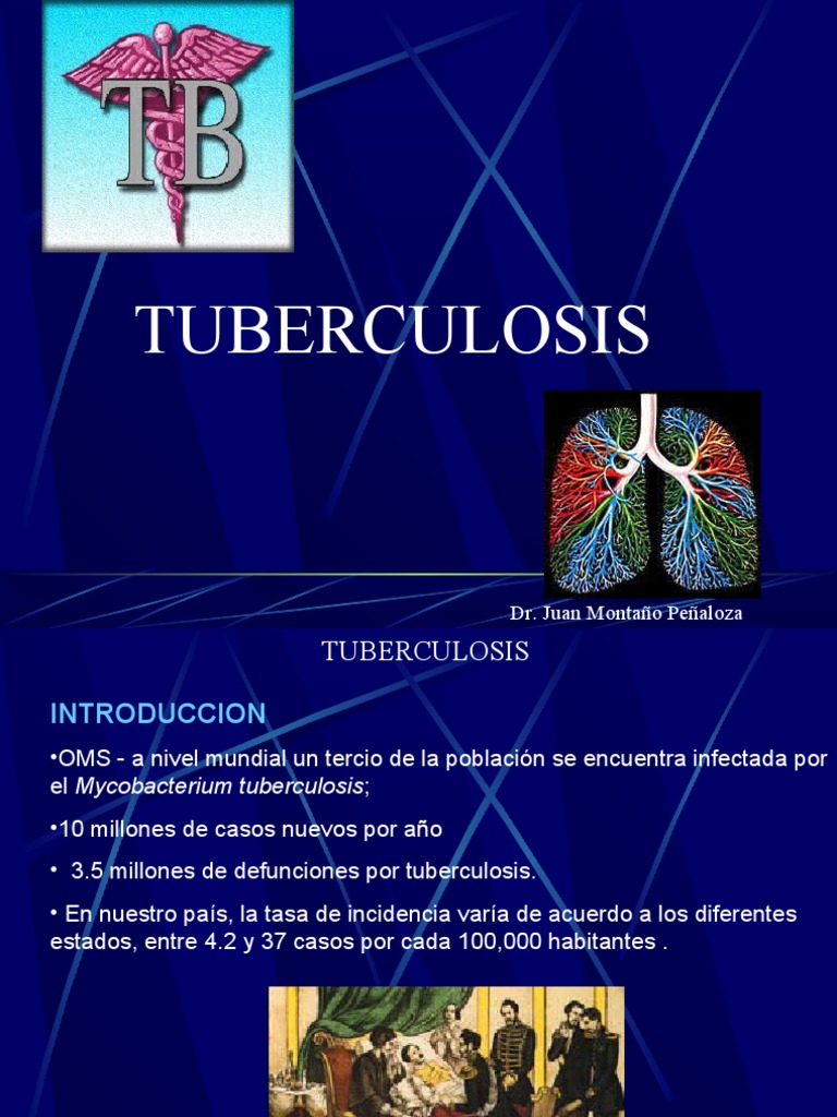 Tuberculosis powerpoint presentation download picture