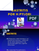 Gastritis Por H.pylori