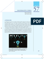 Malformación Uterina