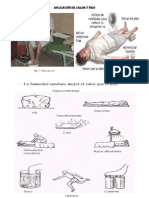 Aplicación de Calor y Frio