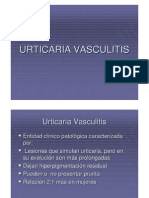 Urticaria Vasculitis
