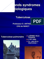 Tuberculose