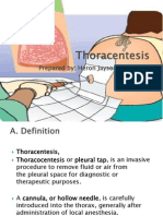  Thoracentesis