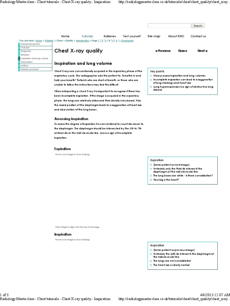 Radiology Masterclass Chest Tutorials Chest XRay Quality