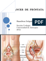 Cáncer de Próstata - Revisión