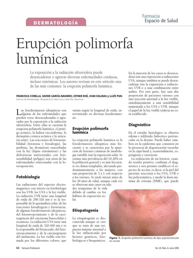 erupci-n-polimorfa-lum-nica-dermatolog-a-pdf