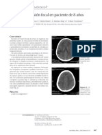 Convulsión Focal en Paciente de 8 Años: Uál Es Su Iagnóstico
