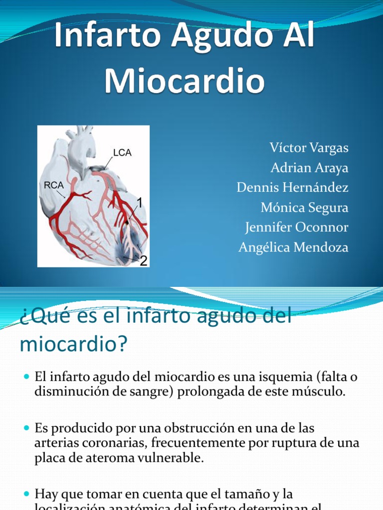 Infarto Agudo de Miocardio: Causas y Síntomas | PDF | Infarto de ...
