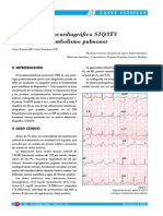 ECG en TEP