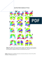 Segmen Paru Pada Gambaran CT Scan