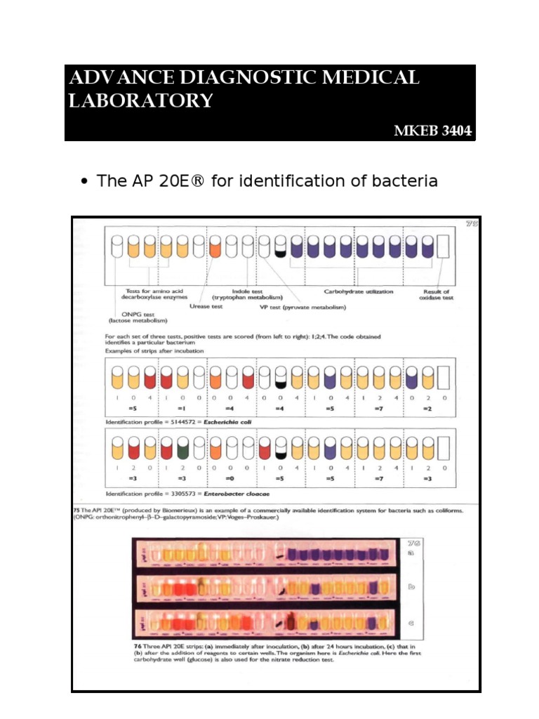 Advance Diagnostic Medical Laboratory: The AP 20E® For Identification ...