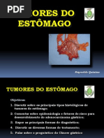 Tumores do Estômago 2009