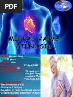 Download mitral stenosis by Plain Gerl SN139047783 doc pdf