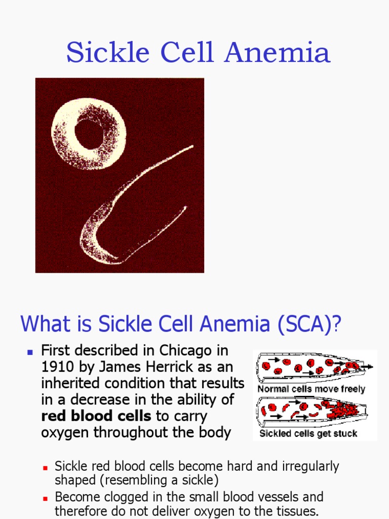 SCD | PDF | Sickle Cell Disease | Red Blood Cell